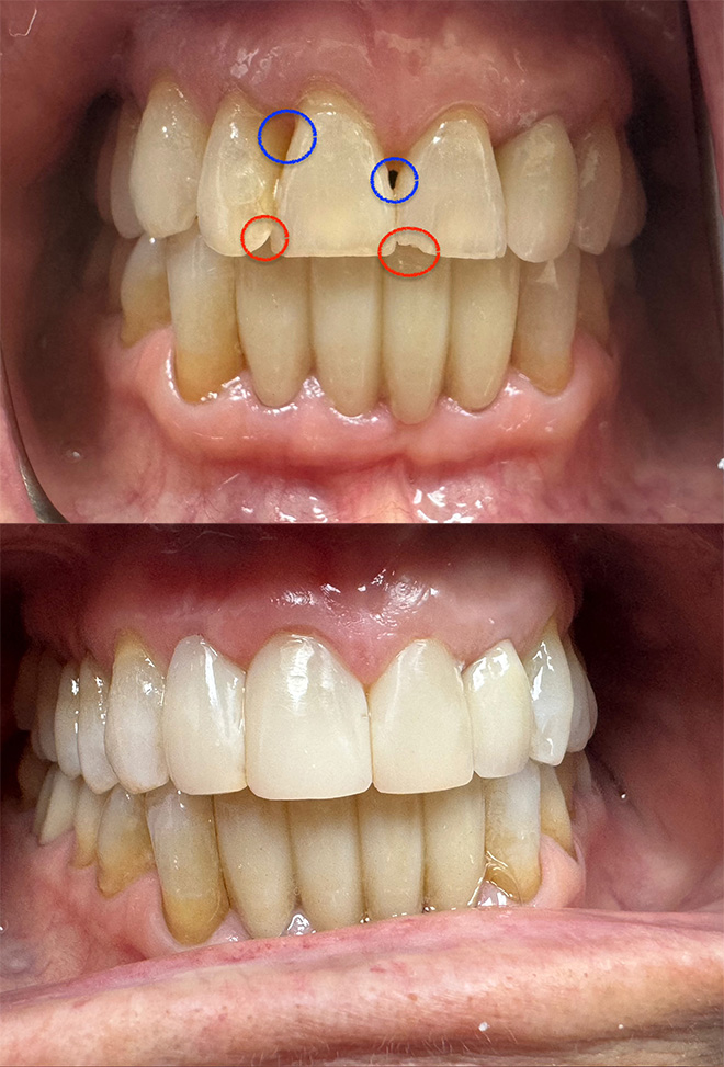One and Truly Holistic Dental | Dentures, BioClear   and Teeth Whitening