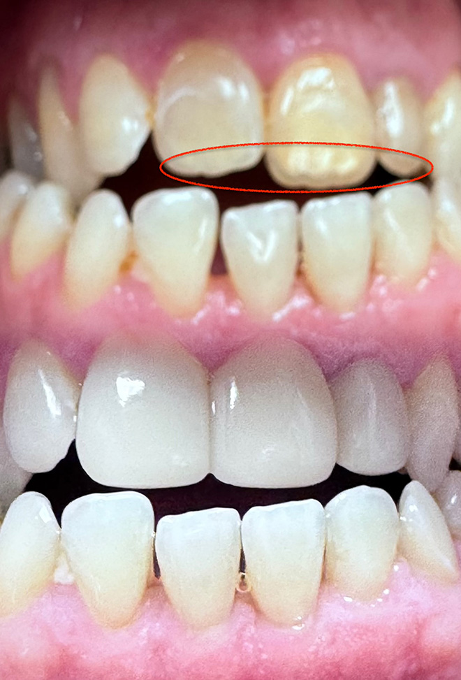 One and Truly Holistic Dental | SmoothLase  , Smart Amalgam Removal and Implant Dentistry