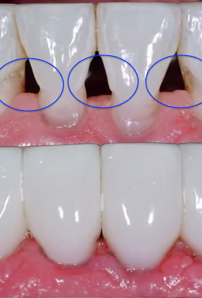 One and Truly Holistic Dental | Zirconia Implants, Biomimetic Treatments and Inlays  amp  Onlays