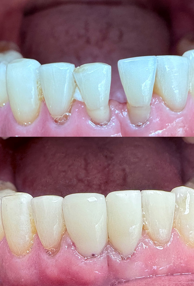 One and Truly Holistic Dental | Gum Surgery, Oral Exams and Crown Lengthening