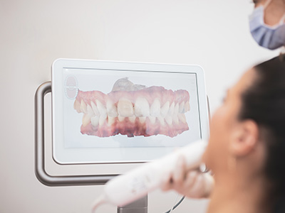iTero   Element Intraoral Scanner in Glen Cove