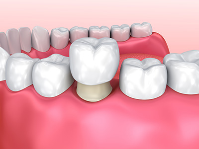 Glen Cove Cosmetic Dentist