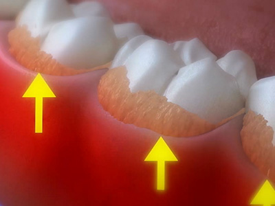 Oral Surgery in Glen Cove