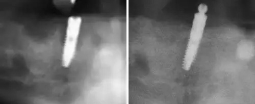 Cosmetic Dentist near Glen Cove