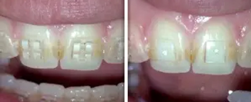 Dentist near Glen Cove