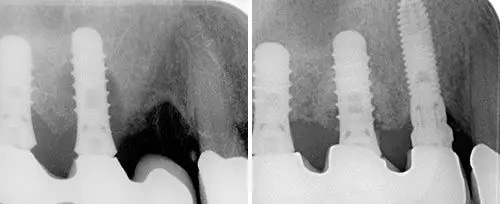 Dentist near Glen Cove