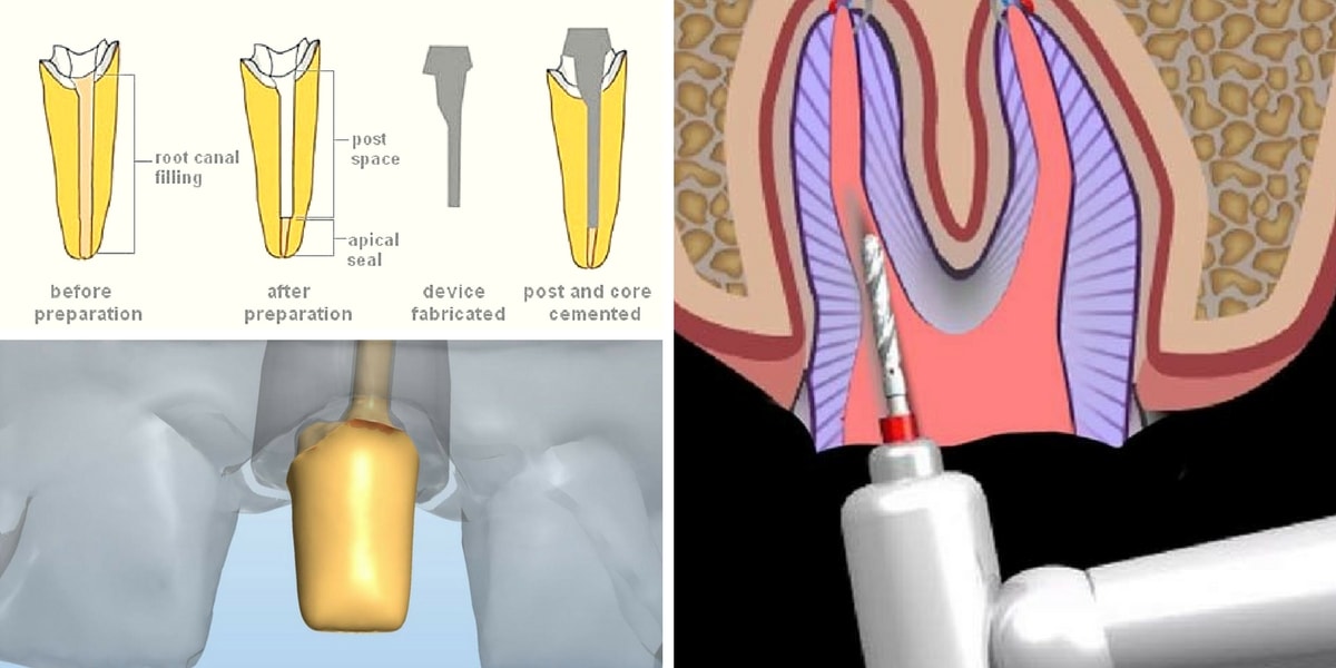 Dentist near Glen Cove