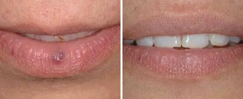 Glen Cove Cosmetic Dentist