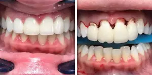 Dentist near Glen Cove