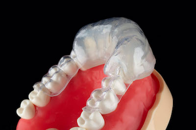 SmileFast in Glen Cove