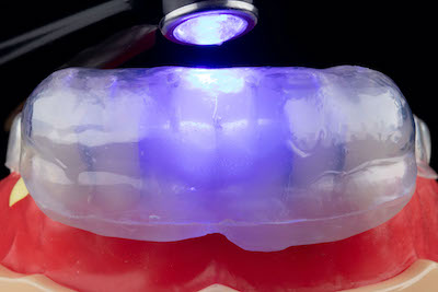 SmileFast in Glen Cove