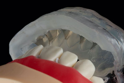 SmileFast in Glen Cove