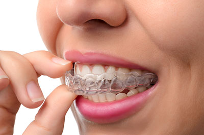 Invisalign in Glen Cove