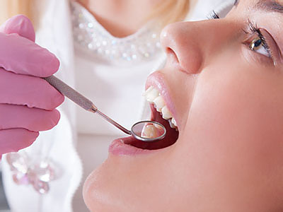Glen Cove Dental Fillings