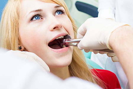 Tooth Extractions in Glen Cove