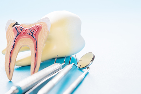 Root Canal Therapy in Glen Cove